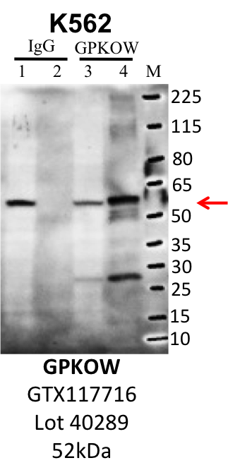 K562_Genetex_GTX117716_40289_GPKOW.png<br>Caption: IP-Western Blot analysis of K562 whole cell lysate using GPKOW specific antibody. Lane 1 is 1% of twenty million whole cell lysate input and lane 2 is 10% of IP enrichment using rabbit normal IgG (lanes under 'IgG'). Lane 3 is 1% of twenty million whole cell lysate input and lane 4 is 10% IP enrichment using rabbit polyclonal anti-GPKOW antibody (lanes under 'GPKOW').