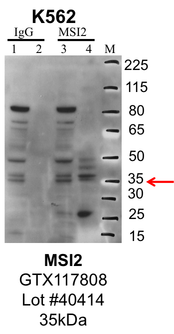 K562_Genetex_GTX117808_40414_MSI2.png<br>Caption: IP-Western Blot analysis of K562 whole cell lysate using MSI2 specific antibody. Lane 1 is 1% of twenty million whole cell lysate input and lane 2 is 25% of IP enrichment using rabbit normal IgG (lanes under 'IgG'). Lane 3 is 1% of twenty million whole cell lysate input and lane 4 is 10% IP enrichment using rabbit polyclonal anti-MSI2 antibody (lanes under 'MSI2').