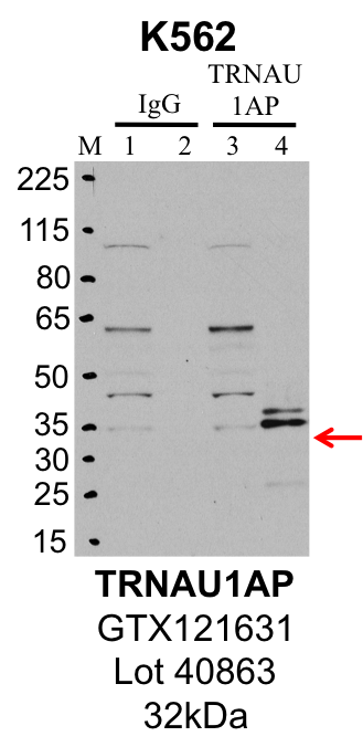 K562_Genetex_GTX121631_40863_TRNAU1AP.png<br>Caption: IP-Western Blot analysis of K562 whole cell lysate using TRNAU1AP specific antibody. Lane 1 is 1% of twenty million whole cell lysate input and lane 2 is 25% of IP enrichment using rabbit normal IgG (lanes under 'IgG'). Lane 3 is 1% of twenty million whole cell lysate input and lane 4 is 10% IP enrichment using rabbit polyclonal anti-TRNAU1AP antibody (lanes under 'TRNAU1AP').