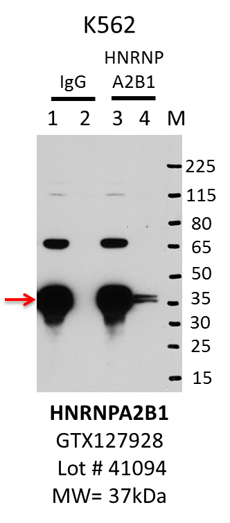 K562_Genetex_GTX127928_41094_HNRNPA2B1.png<br>Caption: IP-Western Blot analysis of K562 whole cell lysate using HNRNPA2B1 specific antibody. Lane 1 is 1% of twenty million whole cell lysate input and lane 2 is 10% of IP enrichment using rabbit normal IgG (lanes under 'IgG'). Lane 3 is 1% of twenty million whole cell lysate input and lane 4 is 10% IP enrichment using rabbit polyclonal hnRNP A2B1 antibody (lanes under 'HNRNPA2B1').