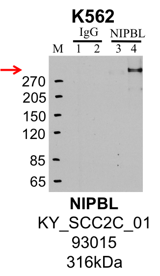 K562_KY_SCC2C_01_93015_NIPBL.png<br>Caption: IP-Western Blot analysis of K562 whole cell lysate using NIPBL specific antibody. Samples were run on a 3-8% Tris-Acetate with Spectra High Range Ladder. Lane 1 is 1% of twenty million whole cell lysate input and lane 2 is 25% of IP enrichment using rabbit normal IgG (lanes under 'IgG'). Lane 3 is 1% of twenty million whole cell lysate input and lane 4 is 10% IP enrichment using rabbit polyclonal anti-NIPBL antibody (lanes under 'NIPBL').