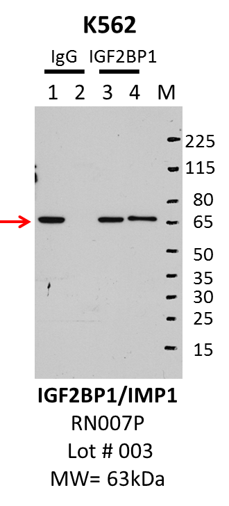 K562_MBLI_RN007P_003_IGF2BP1.png<br>Caption: IP-Western Blot analysis of K562 whole cell lysate using IGF2BP1 specific antibody. Lane 1 is 2.5% of five million whole cell lysate input, lane 2 is 2.5% of supernatant after immunoprecipitation and Lane 3 is 50% of IP enrichment using either rabbit polyclonal anti-IGF2BP1 antibody (lanes under 'IGF2BP1') or using rabbit normal IgG (lanes under 'IgG').