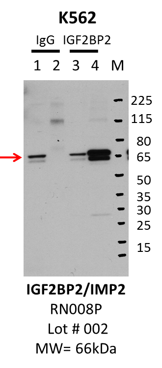 K562_MBLI_RN008P_002_IGF2BP2.png<br>Caption: IP-Western Blot analysis of K562 whole cell lysate using IGF2BP2 specific antibody. Lane 1 is 2.5% of five million whole cell lysate input, lane 2 is 2.5% of supernatant after immunoprecipitation and Lane 3 is 50% of IP enrichment using either rabbit polyclonal anti-IGF2BP2 antibody (lanes under 'IGF2BP2') or using rabbit normal IgG (lanes under 'IgG'). Stars indicate light and heavy chains of IgG background