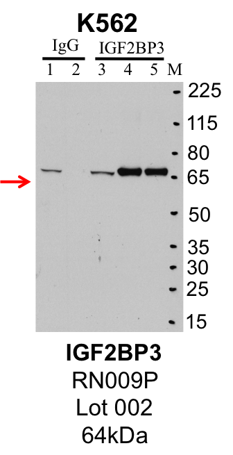 K562_MBLI_RN009P_002_IGF2BP3.png<br>Caption: IP-Western Blot analysis of K562 whole cell lysate using IGF2BP3 specific antibody. Lane 1 is 1% of twenty million whole cell lysate input and lane 2 is 25% of IP enrichment using rabbit normal IgG (lanes under 'IgG'). Lane 3 is 1% of twenty million whole cell lysate input and lanes 4 and 5 are 10% IP enrichments of biological replicates using rabbit polyclonal anti-IGF2BP3 antibody (lanes under 'IGF2BP3').