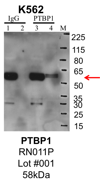 K562_MBLI_RN011P_001_PTBP1.png<br>Caption: IP-Western Blot analysis of K562 whole cell lysate using PTBP1 specific antibody. Lane 1 is 1% of twenty million whole cell lysate input and lane 2 is 25% of IP enrichment using rabbit normal IgG (lanes under 'IgG'). Lane 3 is 1% of twenty million whole cell lysate input and lane 4 is 10% IP enrichment using rabbit polyclonal anti-PTBP1 antibody (lanes under 'PTBP1').