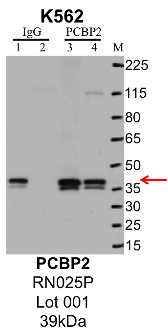 K562_MBLI_RN025P_001_PCBP2.png<br>Caption: IP-Western Blot analysis of K562 whole cell lysate using PCBP2 specific antibody. Lane 1 is 1% of twenty million whole cell lysate input and lane 2 is 25% of IP enrichment using rabbit normal IgG (lanes under 'IgG'). Lane 3 is 1% of twenty million whole cell lysate input and lane 4 is 10% IP enrichment using rabbit polyclonal anti-PCBP2 antibody (lanes under 'PCBP2').