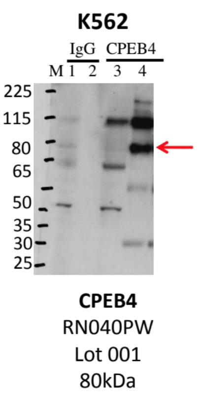 K562_MBLI_RN040PW_001_CPEB4.png<br>Caption: IP-Western Blot analysis of K562 whole cell lysate using CPEB4 specific antibody. Lane 1 is 1% of twenty million whole cell lysate input and lane 2 is 25% of IP enrichment using rabbit normal IgG (lanes under 'IgG'). Lane 3 is 1% of twenty million whole cell lysate input and lane 4 is 10% IP enrichment using rabbit polyclonal anti-CPEB4 antibody (lanes under 'CPEB4').