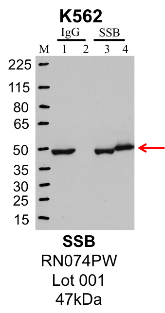 K562_MBLI_RN074PW_001_SSB.png<br>Caption: IP-Western Blot analysis of K562 whole cell lysate using SSB specific antibody. Lane 1 is 1% of twenty million whole cell lysate input and lane 2 is 25% of IP enrichment using rabbit normal IgG (lanes under 'IgG'). Lane 3 is 1% of twenty million whole cell lysate input and lane 4 is 10% IP enrichment using rabbit polyclonal anti-SSB antibody (lanes under 'SSB').