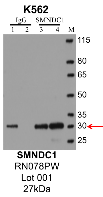 K562_MBLI_RN078PW_001_SMNDC1.png<br>Caption: IP-Western Blot analysis of K562 whole cell lysate using SMNDC1 specific antibody. Lane 1 is 1% of twenty million whole cell lysate input and lane 2 is 10% of IP enrichment using rabbit normal IgG (lanes under 'IgG'). Lane 3 is 1% of twenty million whole cell lysate input and lane 4 is 10% IP enrichment using rabbit polyclonal anti-SMNDC1 antibody (lanes under 'SMNDC1').