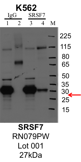 K562_MBLI_RN079PW_001_SRSF7.png<br>Caption: IP-Western Blot analysis of K562 whole cell lysate using SRSF7 specific antibody. Lane 1 is 1% of twenty million whole cell lysate input and lane 2 is 25% of IP enrichment using rabbit normal IgG (lanes under 'IgG'). Lane 3 is 1% of twenty million whole cell lysate input and lane 4 is 10% IP enrichment using rabbit polyclonal anti-SRSF7 antibody (lanes under 'SRSF7').