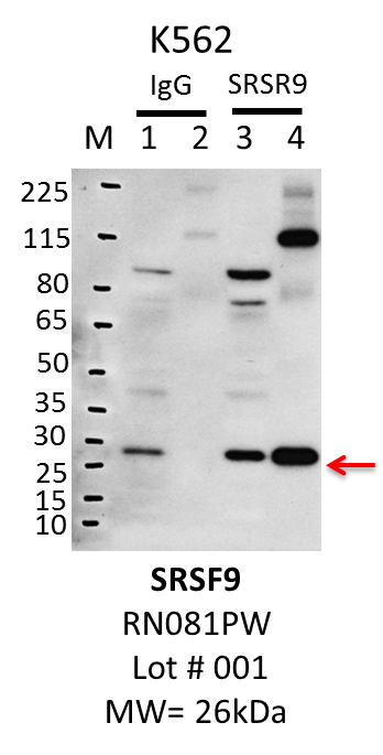 K562_MBLI_RN081PW_001_SRSF9.png<br>Caption: IP-Western Blot analysis of K562 whole cell lysate using SRSF9 specific antibody. Lane 1 is 1% of twenty million whole cell lysate input and lane 2 is 20% of IP enrichment using rabbit normal IgG (lanes under 'IgG'). Lane 3 is 1% of twenty million whole cell lysate input and lane 4 is 20% IP enrichment using rabbit polyclonal anti-SRSF9 antibody (lanes under 'SRSF9').