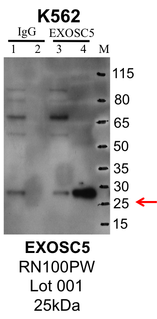 K562_MBLI_RN100PW_001_EXOSC5.png<br>Caption: IP-Western Blot analysis of K562 whole cell lysate using EXOSC5 specific antibody. Lane 1 is 1% of twenty million whole cell lysate input and lane 2 is 25% of IP enrichment using rabbit normal IgG (lanes under 'IgG'). Lane 3 is 1% of twenty million whole cell lysate input and lane 4 is 10% IP enrichment using rabbit polyclonal anti-EXOSC5 antibody (lanes under 'EXOSC5').