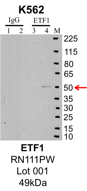 K562_MBLI_RN111PW_001_ETF1.png<br>Caption: IP-Western Blot analysis of K562 whole cell lysate using ETF1 specific antibody. Lane 1 is 1% of twenty million whole cell lysate input and lane 2 is 25% of IP enrichment using rabbit normal IgG (lanes under 'IgG'). Lane 3 is 1% of twenty million whole cell lysate input and lane 4 is 10% IP enrichment using rabbit polyclonal anti-ETF1 antibody (lanes under 'ETF1').