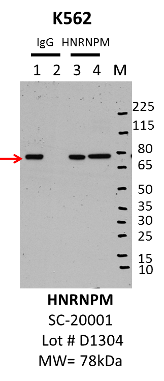 K562_SantaCruz_SC20001_D1304_HNRNPM.png<br>Caption: IP-Western Blot analysis of K562 whole cell lysate using HNRNPM specific antibody. Lane 1 is 1% of twenty million whole cell lysate input and lane 2 is 25% of IP enrichment using mouse normal IgG (lanes under 'IgG'). Lane 3 is 1% of twenty million whole cell lysate input and lane 4 is 10% IP enrichment using mouse monoclonal anti-HNRNPM antibody (lanes under 'HNRNPM').