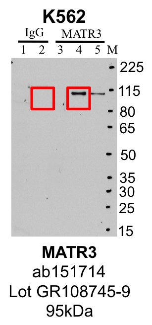 K562_ab151714_GR108745-9_MATR3_MassSpec.png<br>Caption: Representative image of immunoprecipitation performed on whole cell extracts from the K562 cell line using the MATR3-specific antibody ab151714. Lane 1: Input from IP using control IgG. Lane 2: Immunoprecipitated material using control IgG. Lane 3: Input from IP using MATR3 antibody. Lane 4: Immunoprecipitated material using MATR3 antibody. Outlined regions were excised from gel and subjected to analysis by mass spectrometry. Target molecular weight: 94.62 kDa.