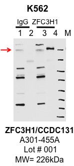 K562_bethyl_A301-455A_1_ZFC3H1.jpg<br>Caption: IP-Western Blot analysis of K562 whole cell lysate using ZFC3H1 specific antibody. Lane 1 is 1% of twenty million whole cell lysate input and lane 2 is 10% of IP enrichment using rabbit normal IgG (lanes under 'IgG'). Lane 3 is 1% of twenty million whole cell lysate input and lane 4 is 10% IP enrichment using rabbit polyclonal CCDC131 Antibody (lanes under 'ZFC3H1').