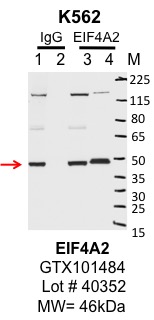 K562_genetex_GTX101484_40352_EIF4A2.jpg<br>Caption: IP-Western Blot analysis of K562 whole cell lysate using EIF4A2 specific antibody. Lane 1 is 1% of twenty million whole cell lysate input and lane 2 is 10% of IP enrichment using rabbit normal IgG (lanes under 'IgG'). Lane 3 is 1% of twenty million whole cell lysate input and lane 4 is 10% IP enrichment using rabbit polyclonal Anti-EIF4A2 antibody (lanes under 'EIF4A2').