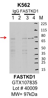 K562_genetex_GTX107835_40009_FASTKD1.jpg<br>Caption: IP-Western Blot analysis of K562 whole cell lysate using FASTKD1 specific antibody. Lane 1 is 1% of twenty million whole cell lysate input and lane 2 is 10% of IP enrichment using rabbit normal IgG (lanes under 'IgG'). Lane 3 is 1% of twenty million whole cell lysate input and lane 4 is 10% IP enrichment using rabbit polyclonal Anti-FASTKD1 pAb antibody (lanes under 'FASTKD1').