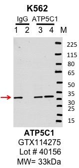 K562_genetex_GTX114275_40156_ATP5C1.jpg<br>Caption: IP-Western Blot analysis of K562 whole cell lysate using ATP5C1 specific antibody. Lane 1 is 1% of twenty million whole cell lysate input and lane 2 is 10% of IP enrichment using rabbit normal IgG (lanes under 'IgG'). Lane 3 is 1% of twenty million whole cell lysate input and lane 4 is 10% IP enrichment using rabbit polyclonal ATP synthase gamma antibody (lanes under 'ATP5C1').