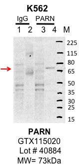 K562_genetex_GTX115020_40884_PARN.jpg<br>Caption: IP-Western Blot analysis of K562 whole cell lysate using PARN specific antibody. Lane 1 is 1% of twenty million whole cell lysate input and lane 2 is 10% of IP enrichment using rabbit normal IgG (lanes under 'IgG'). Lane 3 is 1% of twenty million whole cell lysate input and lane 4 is 10% IP enrichment using rabbit polyclonal Anti-PARN antibody (lanes under 'PARN').