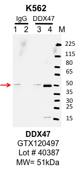 K562_genetex_GTX120497_40387_DDX47.jpg<br>Caption: IP-Western Blot analysis of K562 whole cell lysate using DDX47 specific antibody. Lane 1 is 1% of twenty million whole cell lysate input and lane 2 is 10% of IP enrichment using rabbit normal IgG (lanes under 'IgG'). Lane 3 is 1% of twenty million whole cell lysate input and lane 4 is 10% IP enrichment using rabbit polyclonal Anti-DDX47 antibody (lanes under 'DDX47').