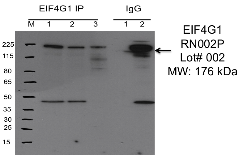 MBLI_RN002P_002_EIF4G1_K562.png<br>Caption: IP-Western Blot analysis of K562 whole cell lysate using EIF4G1 specific antibody. Lane 1 is 2.5% of 0.5mg input lysate, lane 2 is 2.5% of supernatant after immunoprecipitation and Lane 3 is 50% of IP enrichment using rabbit polyclonal Anti-EIF4G1 (Human/Mouse) pAb. This antibody passes preliminary validation and will be further pursued for primary and secondary validation.