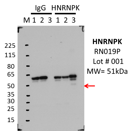 MBLI_RN019P_001_HNRNPK_K562.png<br>Caption: IP-WB characterization of HNRNPK specific antibody in K562 cell line . Lane 1 is 2.5% of five million K562 whole cell lysate Input, lane 2 is 2.5% of supernatant after immunoprecipitation and Lane 3 is 50% of IP enrichment using rabbit polyclonal Anti-HNRNPK(Human)pAb. This antibody passes preliminary validation and will be further pursued for primary and secondary validation.