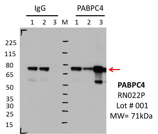 MBLI_RN022P_001_PABPC4_K562.png<br>Caption: IP-Western Blot analysis of K562 whole cell lysate using PABPC4 specific antibody. Lane 1 is 2.5% of 0.5mg input lysate, lane 2 is 2.5% of supernatant after immunoprecipitation and Lane 3 is 50% of IP enrichment using either rabbit polyclonal anti-PABPC4 antibody (lanes under 'PABPC4') or using rabbit normal IgG (lanes under 'IgG').