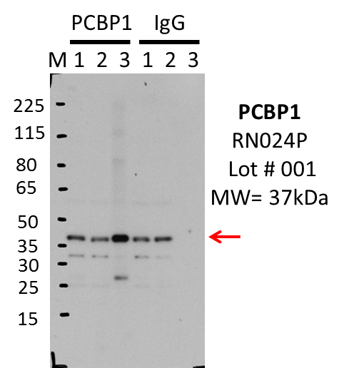 MBLI_RN024P_001_PCBP1.png<br>Caption: IP-Western blot analysis of K562 whole cell lysate using PCBP1 specific antibody. Lane 1 is 2.5% of 0.5mg input lysate, lane 2 is 2.5% of supernatant after immunoprecipitation and Lane 3 is 50% of IP enrichment using rabbit polyclonal Anti-PCBP1 antibody. The last three lanes are the same pattern, but with IgG control instead of PCBP1 antibody.