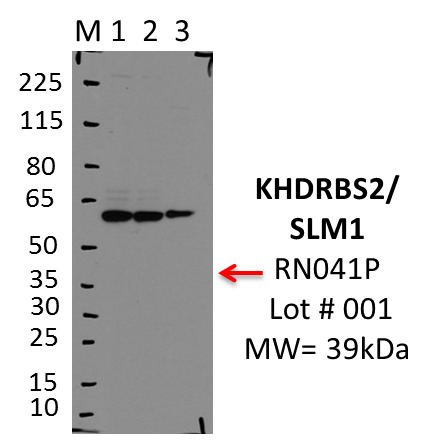 MBLI_RN041P_001_KHDRBS2.png<br>Caption: IP-WB analysis of K562 whole cell lysate using KHDRBS2 specific antibody. Lane 1 is 2.5% of 0.5mg input lysate, lane 2 is 2.5% of supernatant after immunoprecipitation and Lane 3 is 50% of IP enrichment using rabbit polyclonal Anti-KHDRBS2(SLM1)(Human)pAb. This antibody passes preliminary validation and will be further pursued for primary and secondary validation.