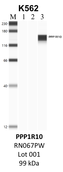 MBL_RN067PW_001_PPP1R10.png<br>Caption: IP-WB analysis of K562 whole cell lysate using the PPP1R10 specific antibody, RN067PW. Lane 1 is 2.5% of five million whole cell lysate input. Lanes 2 and 3 are 50% of IP enrichment from five million whole cell lysate using normal IgG antibody and the PPP1R10-specific antibody, RN067PW. The same antibody was used to detect protein levels via Western blot. This antibody passes preliminary validation and will be further pursued for secondary validation. *NOTE* Protein sizes are taken from Genecards.org and are only estimates based on sequence. Actual protein size may differ based on protein characteristics and electrophoresis method used.