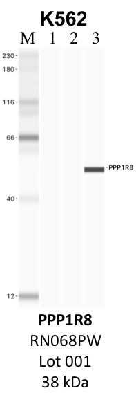 MBL_RN068PW_001_PPP1R8.png<br>Caption: IP-WB analysis of K562 whole cell lysate using the PPP1R8 specific antibody, RN068PW. Lane 1 is 2.5% of five million whole cell lysate input. Lanes 2 and 3 are 50% of IP enrichment from five million whole cell lysate using normal IgG antibody and the PPP1R8-specific antibody, RN068PW. The same antibody was used to detect protein levels via Western blot. This antibody passes preliminary validation and will be further pursued for secondary validation. *NOTE* Protein sizes are taken from Genecards.org and are only estimates based on sequence. Actual protein size may differ based on protein characteristics and electrophoresis method used.