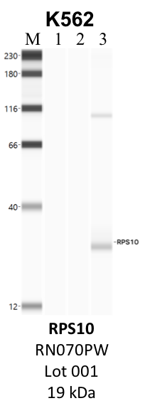 MBL_RN070PW_001_RPS10.png<br>Caption: IP-WB analysis of K562 whole cell lysate using the RPS10 specific antibody, RN070PW. Lane 1 is 2.5% of five million whole cell lysate input. Lanes 2 and 3 are 50% of IP enrichment from five million whole cell lysate using normal IgG antibody and the RPS10-specific antibody, RN070PW. The same antibody was used to detect protein levels via Western blot. This antibody passes preliminary validation and will be further pursued for secondary validation. *NOTE* Protein sizes are taken from Genecards.org and are only estimates based on sequence. Actual protein size may differ based on protein characteristics and electrophoresis method used.