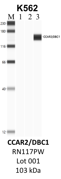 MBL_RN117PW_001_CCAR2.png<br>Caption: IP-WB analysis of K562 whole cell lysate using the CCAR2 specific antibody, RN117PW. Lane 1 is 2.5% of five million whole cell lysate input. Lanes 2 and 3 are 50% of IP enrichment from five million whole cell lysate using normal IgG antibody and the CCAR2-specific antibody, RN117PW. The same antibody was used to detect protein levels via Western blot. This antibody passes preliminary validation and will be further pursued for secondary validation. *NOTE* Protein sizes are taken from Genecards.org and are only estimates based on sequence. Actual protein size may differ based on protein characteristics and electrophoresis method used.