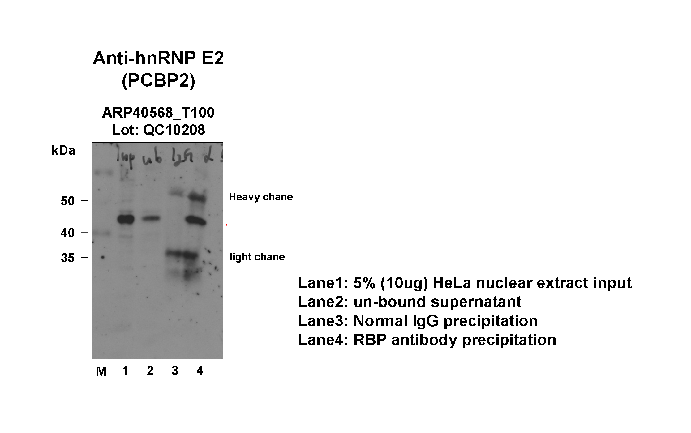 PCBP2_aviva-2_IP-WB_HeLa_Fu.png<br>Caption: Immunoprecipitation from HeLa whole cell lysate and analized by western blot analysis uisng rabbit polyclonal to PCBP2. Expected size: ~39kDa.