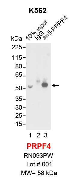 PRPF4_K562.png<br>Caption: IP-Western Blot analysis of K562 whole cell lysate using PRPF4 specific antibody. Lane 1 is 2% of ten million whole cell lysate input (lane under '10% input') , lane 2 is 20% of IP enrichment using rabbit normal IgG (lane under 'IgG') and lane 3 is 20% IP enrichment using rabbit polyclonal anti-PRPF4 antibody (lanes under 'anti-PRPF4').