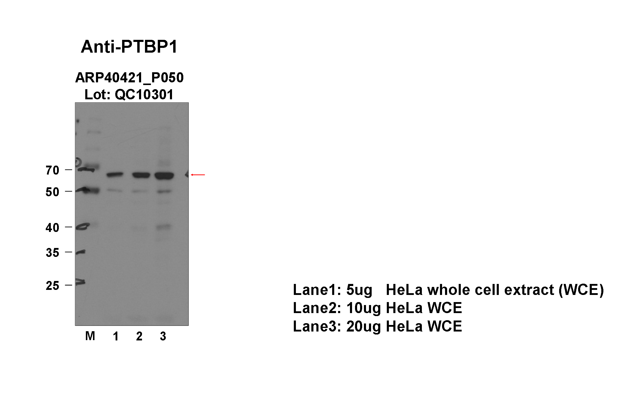 PTBP1_aviva-1_WB_HeLa_Fu.png<br>Caption: Western blot analysis of lysates from HeLa cells using rabbit polyclonal to PTBP1. Expected size: ~57.2kDa