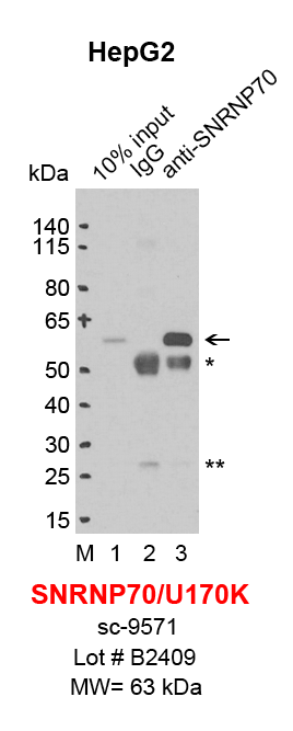 SNRNP70_HepG2.png<br>Caption: IP-Western Blot analysis of HepG2 whole cell lysate using SNRNP70/U170K specific antibody. Lane 1 is 2% of ten million whole cell lysate input (lane under '10% input') , lane 2 is 20% of IP enrichment using goat normal IgG (lane under 'IgG') and lane 3 is 20% IP enrichment using goat polyclonal anti-SNRNP70/U170K antibody (lanes under 'anti-SNRNP70'). Asterisk indicates heavy and light chains of antibody.