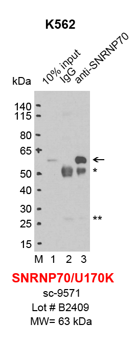 SNRNP70_K562_png.png<br>Caption: IP-Western Blot analysis of K562 whole cell lysate using SNRNP70/U170K specific antibody. Lane 1 is 2% of ten million whole cell lysate input (lane under '10% input') , lane 2 is 20% of IP enrichment using goat normal IgG (lane under 'IgG') and lane 3 is 20% IP enrichment using goat polyclonal anti-SNRNP70/U170K antibody (lanes under 'anti-SNRNP70'). Asterisk indicates heavy and light chains of antibody.