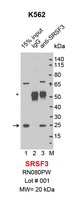 SRSF3_K562.png<br>Caption: IP-Western Blot analysis of K562 whole cell lysate using SRSF3 specific antibody. Lane 1 is 3% of ten million whole cell lysate input (lane under '15% input') , lane 2 is 20% of IP enrichment using rabbit normal IgG (lane under 'IgG') and lane 3 is 20% IP enrichment using rabbit polyclonal anti-SRSF3 antibody (lanes under 'anti-SRSF3'). Asterisk indicates heavy chain of antibody.