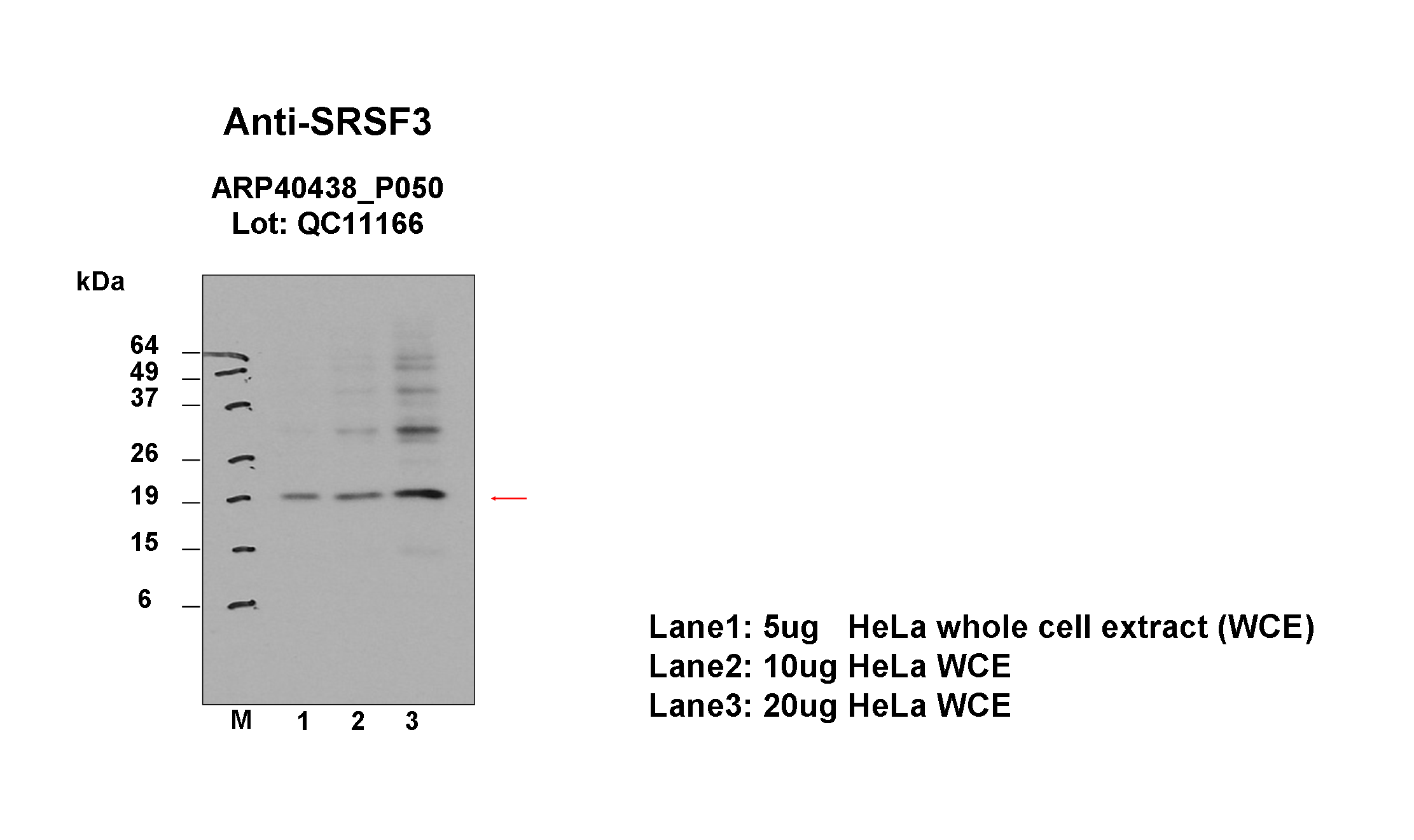 SRSF3_aviva-1_WB_HeLa_Fu.png<br>Caption: Western blot analysis of lysates from HeLa cells using rabbit polyclonal to SRSF3