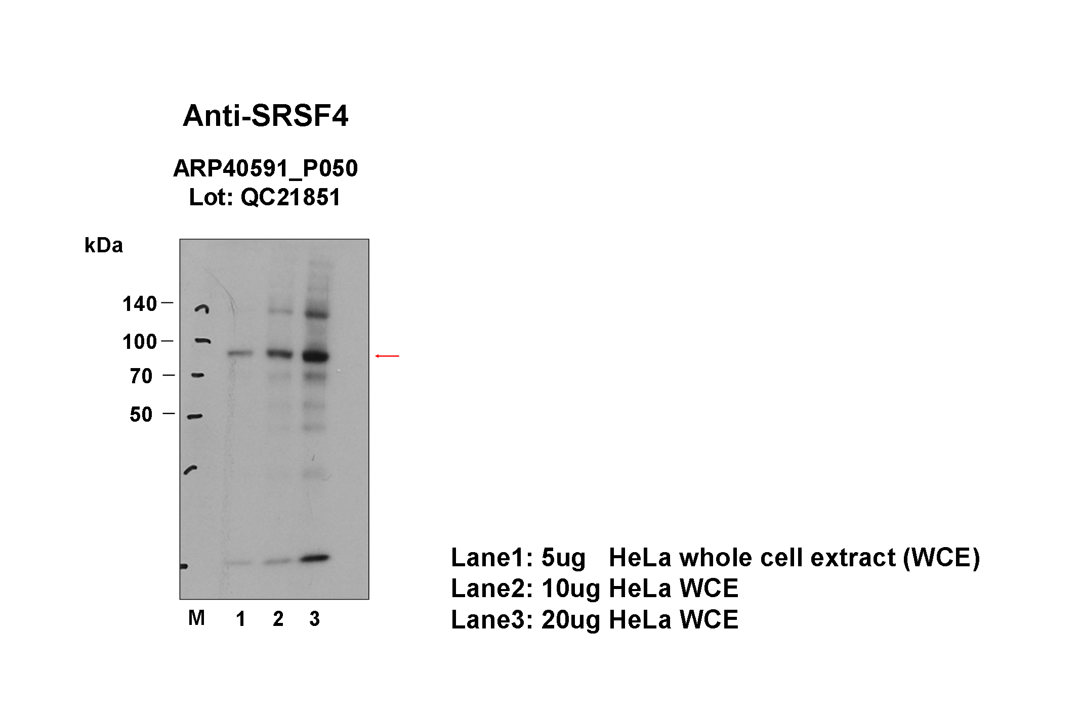 SRSF4_aviva-1_WB_HeLa_Fu.png<br>Caption: Western blot analysis of lysates from HeLa cells using rabbit polyclonal to SRSF4