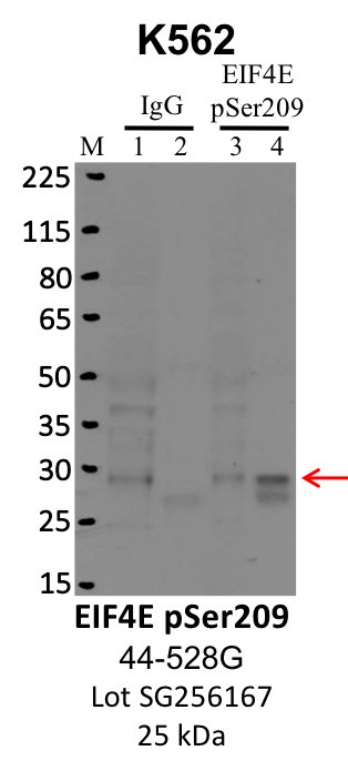 ThermoFisher_44-528G_SG256167_EIF4EpSer209.png<br>Caption: IP-WB analysis of K562 whole cell lysate using the EIF4E pSer209 specific antibody, 44-528G. Lanes 1 and 3 are 2.5% of five million whole cell lysate input. Lanes 2 and 4 are 50% of IP enrichment from five million whole cell lysate using normal IgG antibody and the EIF4E pSer209-specific antibody, 44-528G. The same antibody was used to detect protein levels via Western blot. This antibody passes preliminary validation and will be further pursued for secondary validation. *NOTE* Protein sizes are taken from Genecards.org and are only estimates based on sequence. Actual protein size may differ based on protein characteristics and electrophoresis method used.