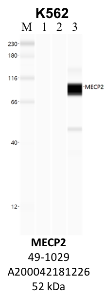 ThermoFisher_49-1029_A200042181226_MECP2.png<br>Caption: IP-WB analysis of K562 whole cell lysate using the MECP2 specific antibody, 49-1029. Lane 1 is 2.5% of five million whole cell lysate input. Lanes 2 and 3 are 50% of IP enrichment from five million whole cell lysate using normal IgG antibody and the MECP2-specific antibody, 49-1029. The same antibody was used to detect protein levels via Western blot. This antibody passes preliminary validation and will be further pursued for secondary validation. *NOTE* Protein sizes are taken from Genecards.org and are only estimates based on sequence. Actual protein size may differ based on protein characteristics and electrophoresis method used.