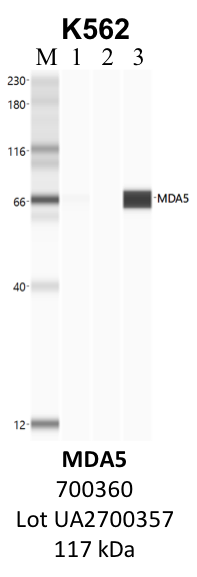 ThermoFisher_700360_UA2700357_MDA5.png<br>Caption: IP-WB analysis of K562 whole cell lysate using the MDA5 specific antibody, 700360. Lane 1 is 2.5% of five million whole cell lysate input. Lanes 2 and 3 are 50% of IP enrichment from five million whole cell lysate using normal IgG antibody and the MDA5-specific antibody, 700360. The same antibody was used to detect protein levels via Western blot. This antibody passes preliminary validation and will be further pursued for secondary validation. *NOTE* Protein sizes are taken from Genecards.org and are only estimates based on sequence. Actual protein size may differ based on protein characteristics and electrophoresis method used.