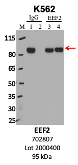 ThermoFisher_702807_2000400_EEF2.png<br>Caption: IP-WB analysis of K562 whole cell lysate using the EEF2 specific antibody, 702807. Lanes 1 and 3 are 2.5% of five million whole cell lysate input. Lanes 2 and 4 are 50% of IP enrichment from five million whole cell lysate using normal IgG antibody and the EEF2-specific antibody, 702807. The same antibody was used to detect protein levels via Western blot. This antibody passes preliminary validation and will be further pursued for secondary validation. *NOTE* Protein sizes are taken from Genecards.org and are only estimates based on sequence. Actual protein size may differ based on protein characteristics and electrophoresis method used.