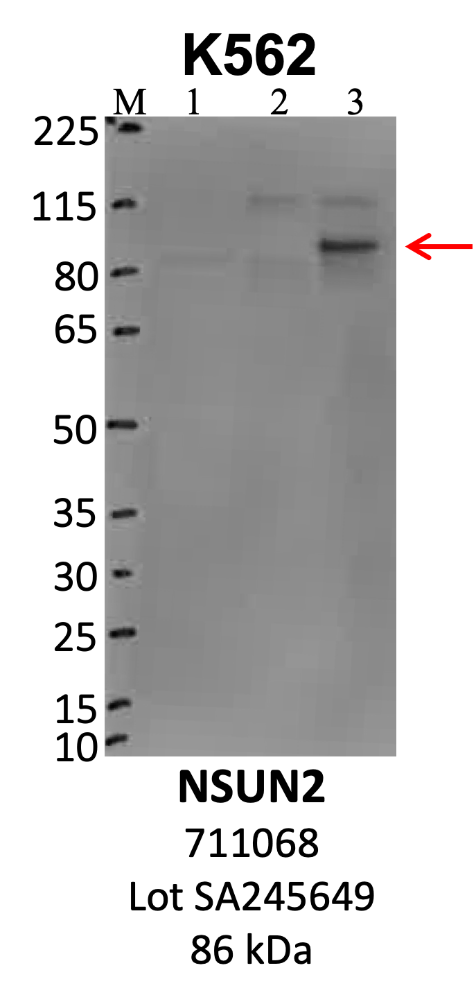 ThermoFisher_711068_SA245649_NSUN2_HepG2.png<br>Caption: IP-WB analysis of HepG2 whole cell lysate using the NSUN2 specific antibody, 711068. Lanes 1 and 2 are 2.5% of five million whole cell lysate input and 50% of IP enrichment using a normal IgG antibody, respectively. Lane 3 is 50% of IP enrichment from five million whole cell lysate using the NSUN2-specific antibody, 711068. The same antibody was used to detect protein levels via Western blot. This antibody passes preliminary validation and will be further pursued for secondary validation. *NOTE* Protein sizes are taken from Genecards.org and are only estimates based on sequence. Actual protein size may differ based on protein characteristics and electrophoresis method used.