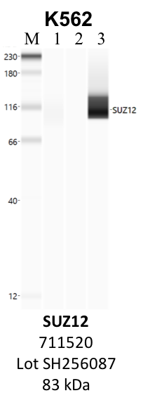 ThermoFisher_711520_SH256087_SUZ12.png<br>Caption: IP-WB analysis of K562 whole cell lysate using the SUZ12 specific antibody, 711520. Lane 1 is 2.5% of five million whole cell lysate input. Lanes 2 and 3 are 50% of IP enrichment from five million whole cell lysate using normal IgG antibody and the SUZ12-specific antibody, 711520. The same antibody was used to detect protein levels via Western blot. This antibody passes preliminary validation and will be further pursued for secondary validation. *NOTE* Protein sizes are taken from Genecards.org and are only estimates based on sequence. Actual protein size may differ based on protein characteristics and electrophoresis method used.