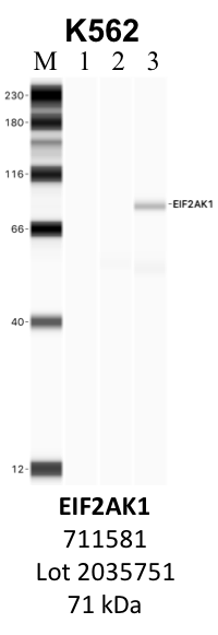 ThermoFisher_711581_2035751_EIF2AK1.png<br>Caption: IP-WB analysis of K562 whole cell lysate using the EIF2AK1 specific antibody, 711581. Lanes 1 and 2 are 2.5% of five million whole cell lysate input and 50% of IP enrichment, respectively, using a normal IgG antibody. Lane 3 is 50% of IP enrichment from five million whole cell lysate using the EIF2AK1-specific antibody, 711581. The same antibody was used to detect protein levels via Western blot. This antibody passes preliminary validation and will be further pursued for secondary validation. *NOTE* Protein sizes are taken from Genecards.org and are only estimates based on sequence. Actual protein size may differ based on protein characteristics and electrophoresis method used.