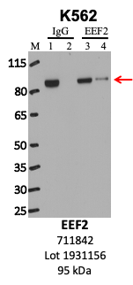 ThermoFisher_711842_1931156_EEF2.png<br>Caption: IP-WB analysis of K562 whole cell lysate using the EEF2 specific antibody, 711842. Lanes 1 and 3 are 2.5% of five million whole cell lysate input. Lanes 2 and 4 are 50% of IP enrichment from five million whole cell lysate using normal IgG antibody and the EEF2-specific antibody, 711842. The same antibody was used to detect protein levels via Western blot. This antibody passes preliminary validation and will be further pursued for secondary validation. *NOTE* Protein sizes are taken from Genecards.org and are only estimates based on sequence. Actual protein size may differ based on protein characteristics and electrophoresis method used.